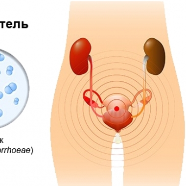 Teenage Mutant Ninja Turtles секс мультфильмі