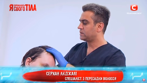 Консультація з пересадки волосся, проводить фахівець з Туреччини Серхан Акджам