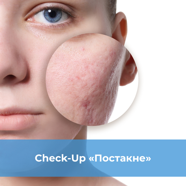 Чекап